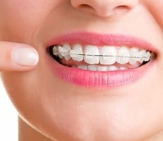 Orthodontics